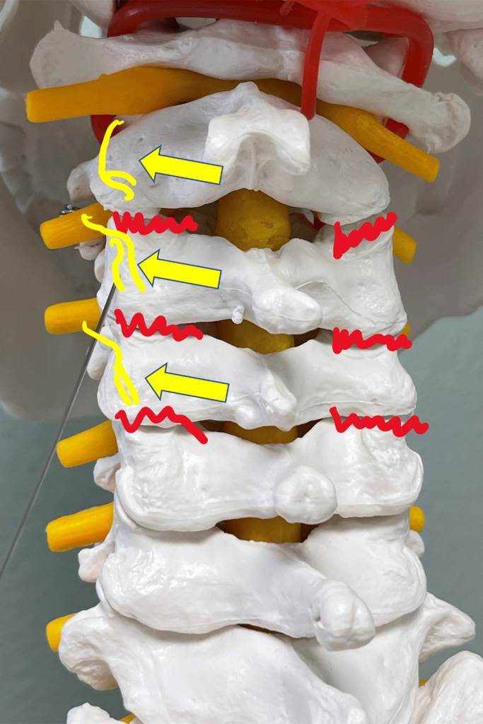 Ton Cervical Medial Branch Block